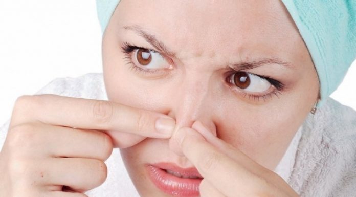 The Best and Simple Tips How To Get Rid of Blackheads Faster tips how to get rid of blackheads