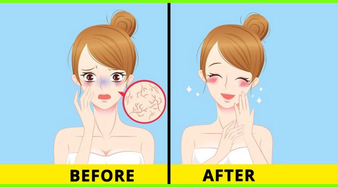 Tips For Dry Face – How to Deal With Dry Skin