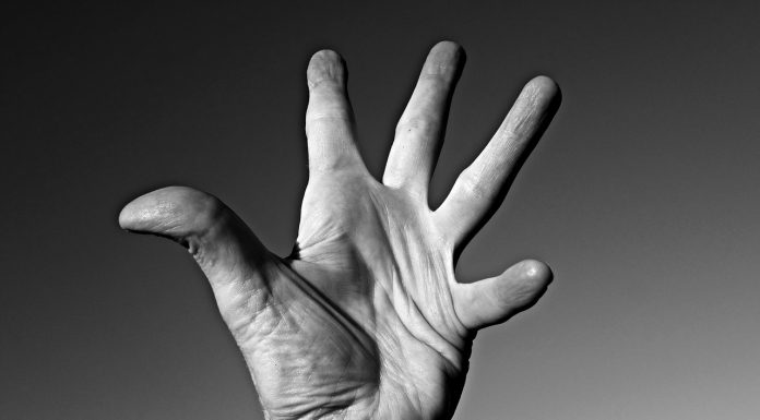 Crooked Fingers Causes – What Are the Causes of Crooked Fingers?