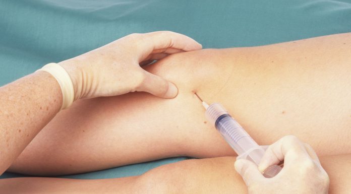 Hip Joint Aspiration